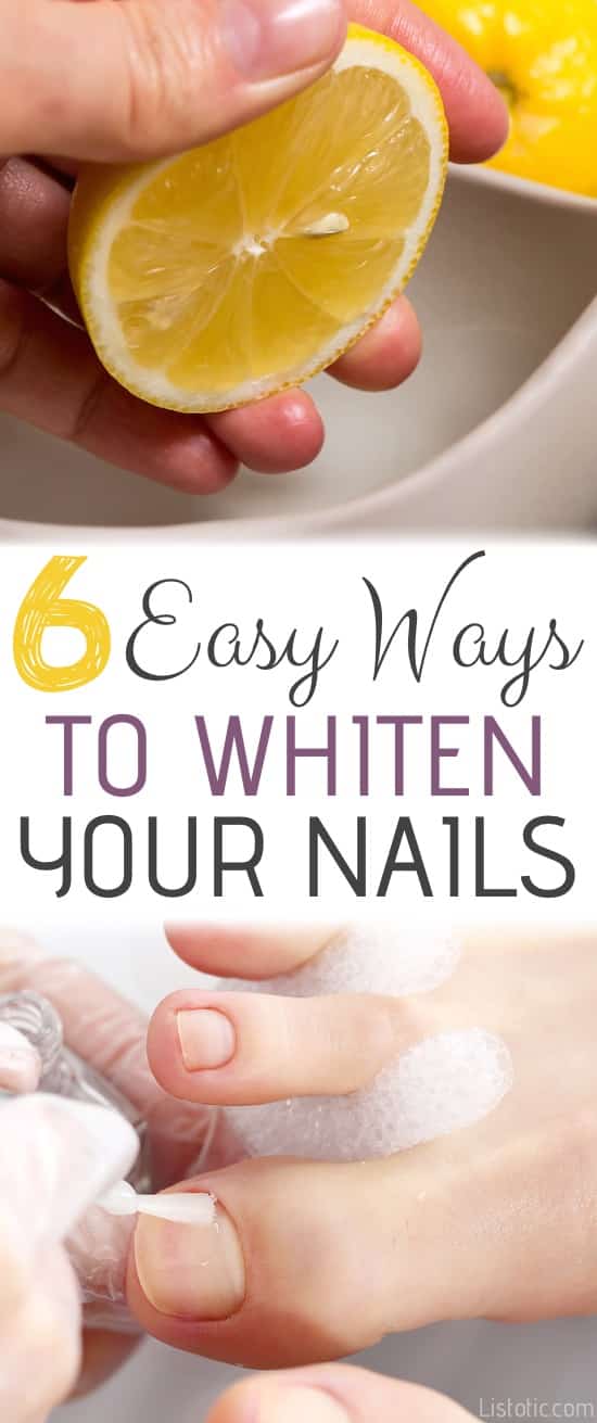 How to whiten nails? 9 home remedies you can use to get rid of yellow nails  and whiten them at home | India.com