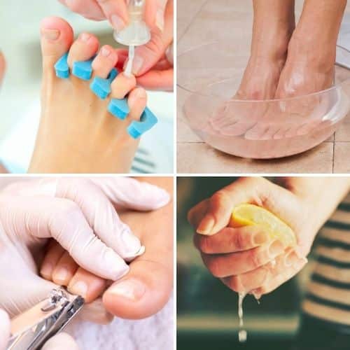 How to Get Healthy Toenails Best Tips & Home Remedies ⋆ Listotic