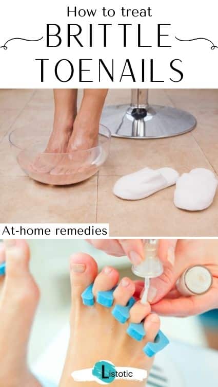 How to make toe nails healthier