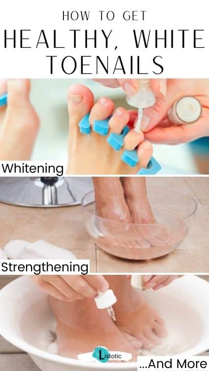 How to have healthy, whiter toenails.