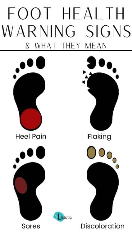 Feet health warning signs to look out for.